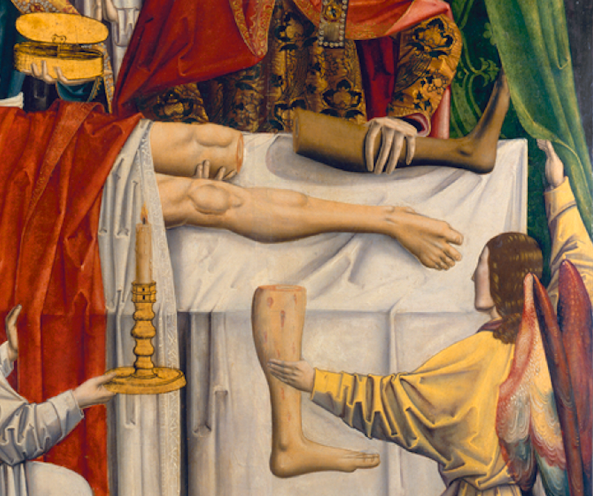 Saint Cosme et Saint Damien procédant à une guérison miraculeuse par la transplantation d'une jambe, peinture attribuée au Maître de Los Balbases, vers 1495